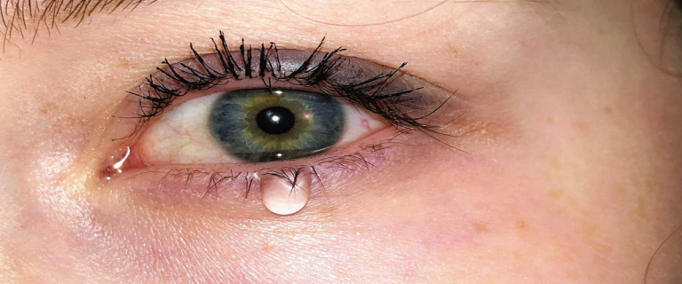 ojo